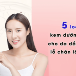 kem duong am danh cho da dau mun lo chan long to